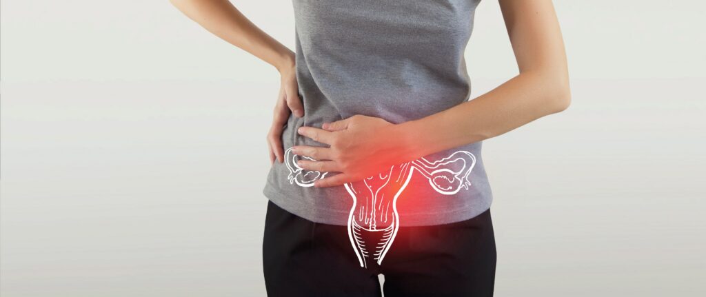 PCOD / PCOS Polycystic Ovary Syndrome PCOS ad4de67678