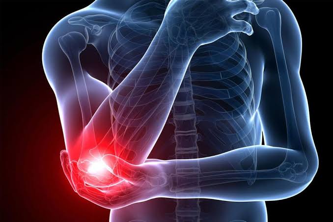 Elbow Pain images 21